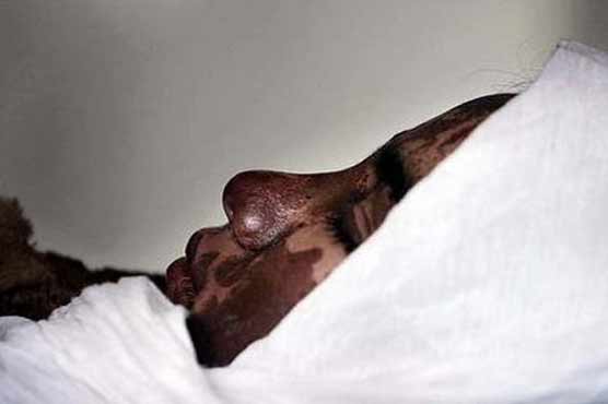 Boy, girl killed in Afghan acid attack