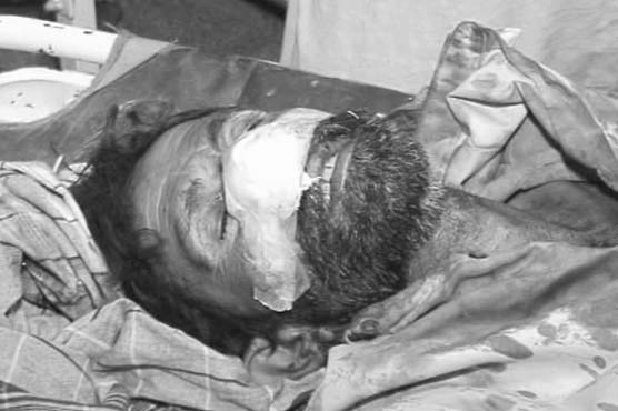 Rojhan: Mans nose of chopped off