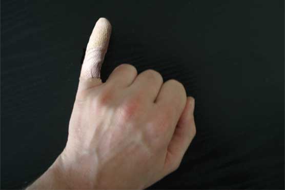 Japanese woman bites off mugger's finger