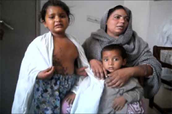 Chiniot: Mother, daughter attacked with acid