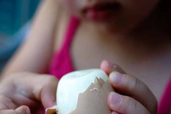 Kids can overcome egg allergy 