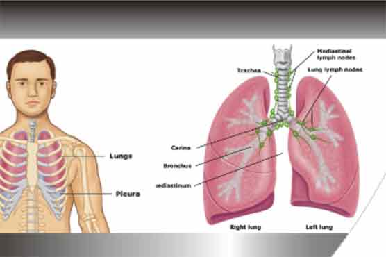 Lung cancer gene found in non-smokers 