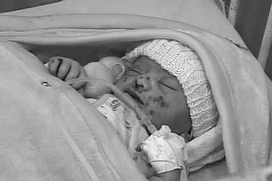 Four employees suspended after rat biting incident