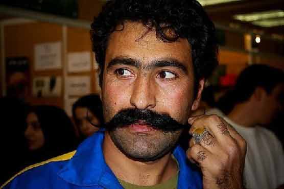 Mustache transplants on the rise in Middle East