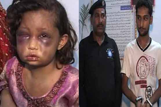 Lahore: Man tortures 7-year-old sister-in-law 