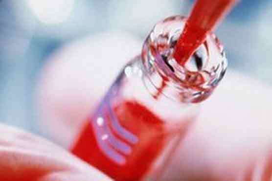 Blood signatures for aggressive prostate cancer found