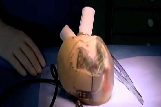 Clinic develops smart artificial heart