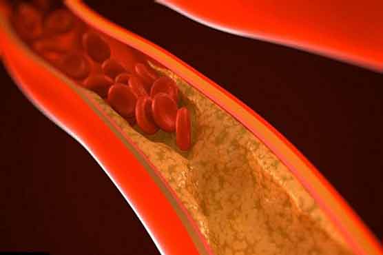 Scientists identify genes linked to cholesterol levels