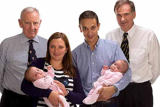 Parents joy as doctors separate conjoined twins 