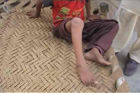 Polio case appears in Dipalpur 