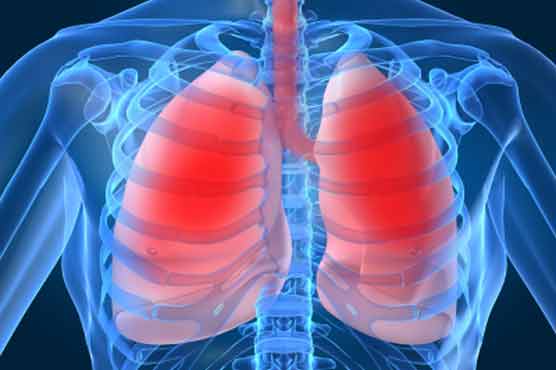  WHO doubtful about respiratory disease
