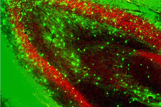 Most mental disability cases not inherited: study