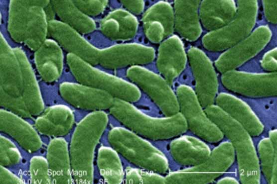 Woman attacked by rare bacteria fighting for life 