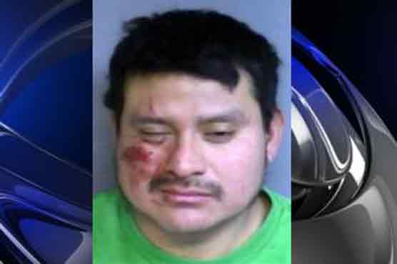 Man charged with biting off ear lobe pleads not guilty