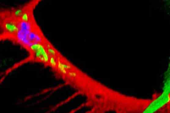 Leprosy spreads to other tissues in operation