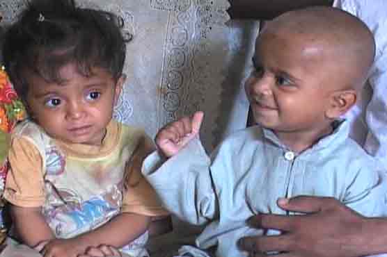 11 children die of measles in Punjab, Sindh death toll above 410 
