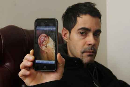 NY police slice off man's ear for no reason