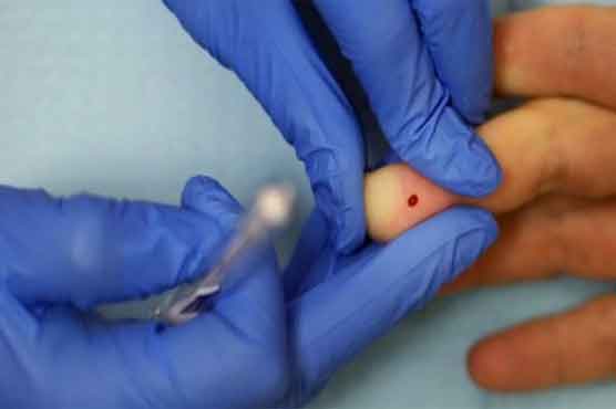 10 million more people advised to take HIV drugs: UN