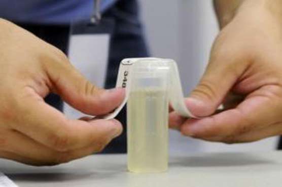 Urine test can diagnose, predict kidney transplant rejection