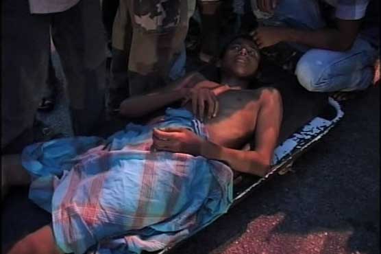 Karachi: Police severely torture 13-year-old boy 