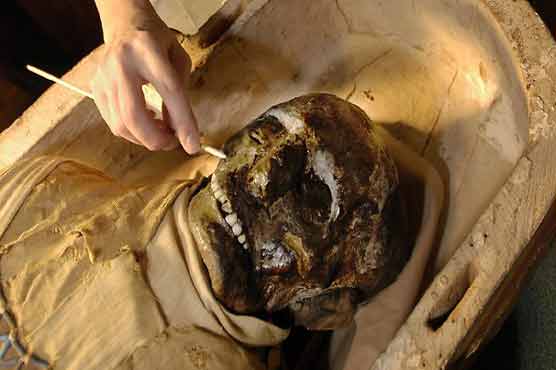 Boston hospital cleans 2,500-year-old mummy