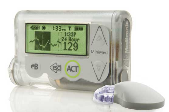Doctors make progress toward 'artificial pancreas'