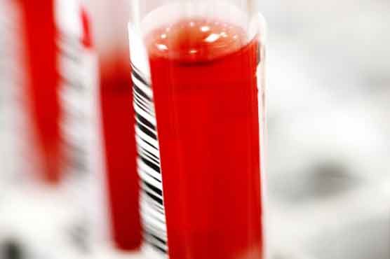 Ten million more people advised to take HIV drugs