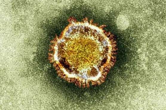 Three new cases of SARS-like virus in Saudi Arabia