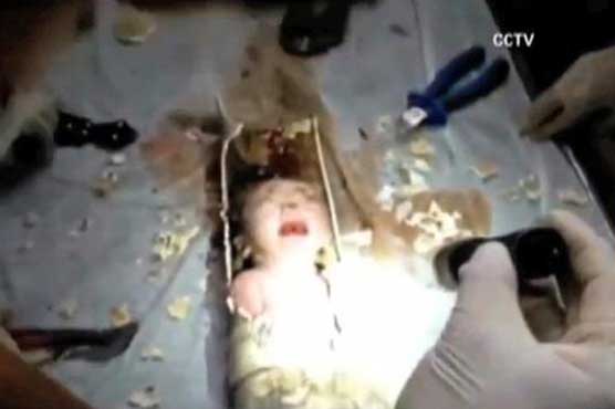 Newborn flushed down toilet saved