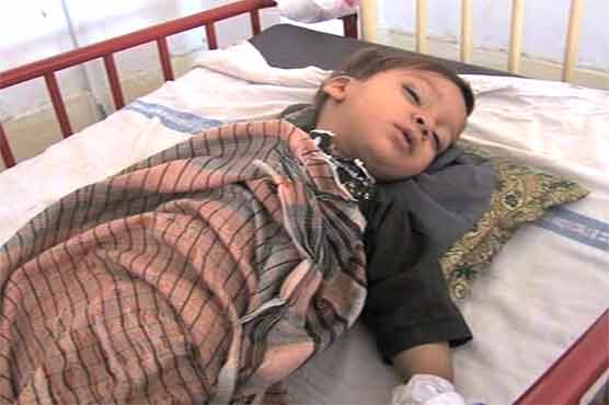 241 more measles cases reported in Punjab