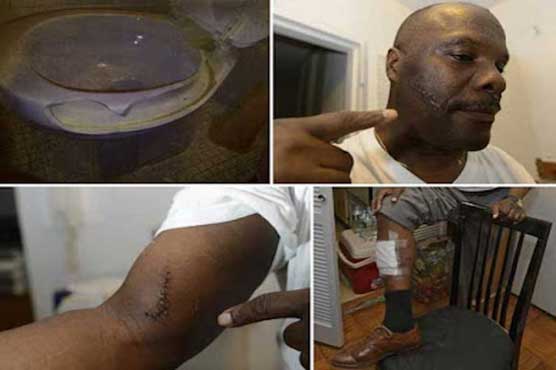 Man hit by exploding toilet