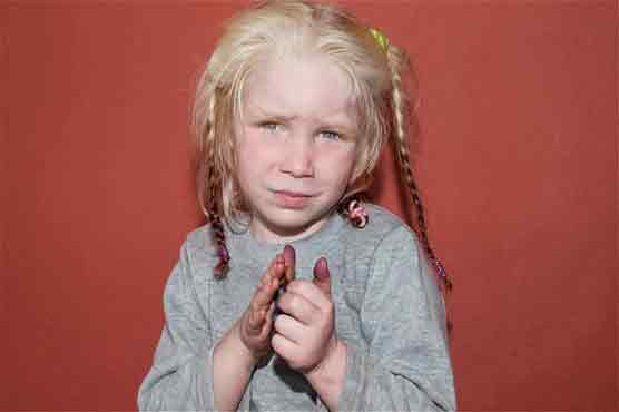 Dublin: Fake child removed from Roma family 