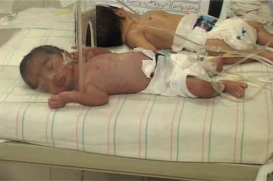 فیصل آباد میں خاتون کے ہاں 4 بچوں کی پیدائش