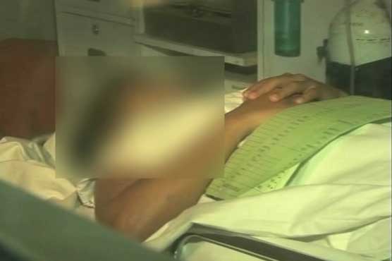 Girl injured as result of acid attack in Lahore