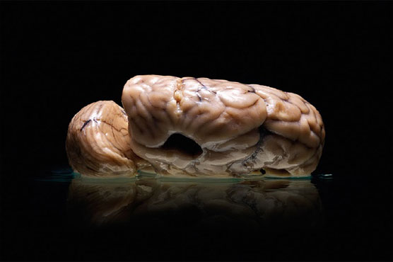 Texas university loses 100 human brains
