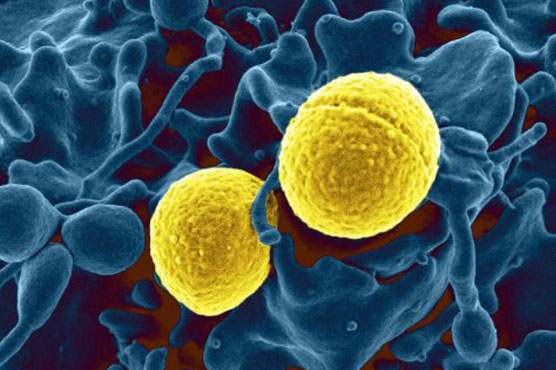 Resistance to antibiotics could account for 10 million deaths a year