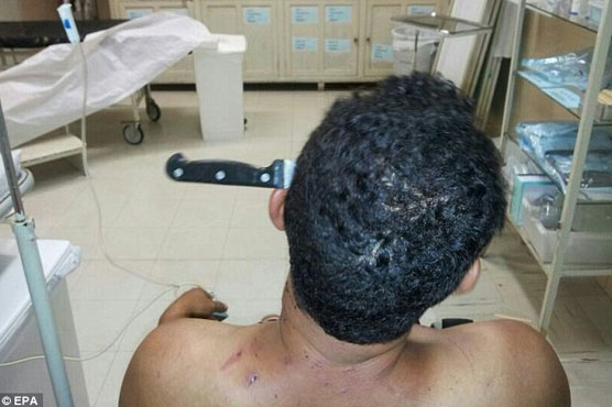 Brazilian, with knife in skull drives two hours to hospital