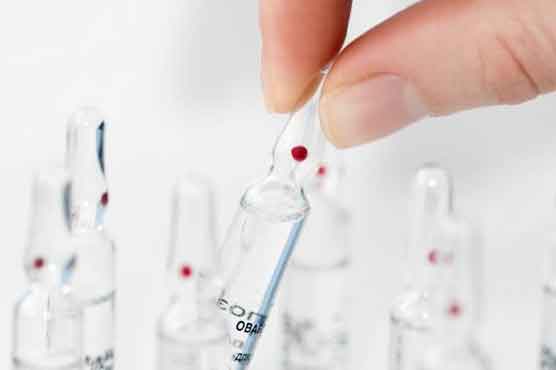 Relapse of 'cured' HIV patients spurs AIDS science on