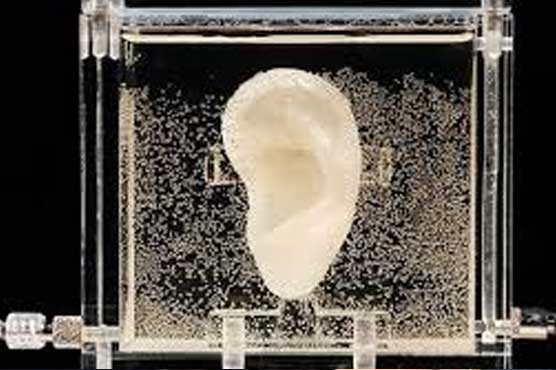 Living replica of van Gogh's ear on display in Germany