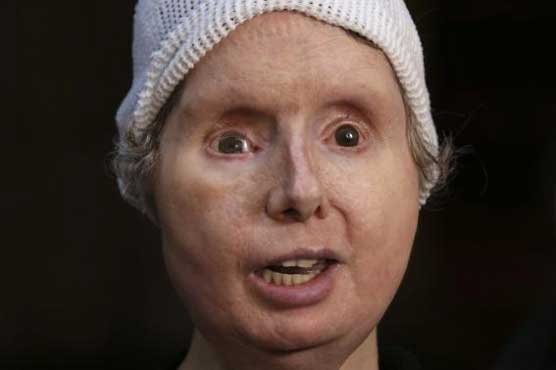 Connecticut chimp attack victim seeks right to sue state