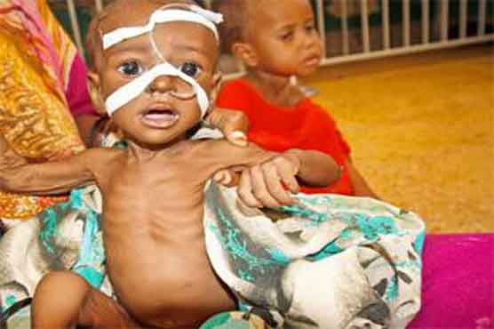 200,000 kids may starve in Somalia as aid runs dry: UNICEF