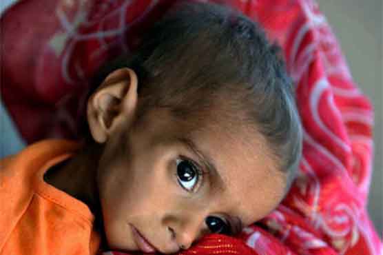Famine takes 2 more lives in Tharparkar