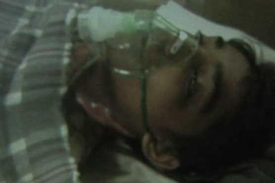 14-year-old boy set on fire