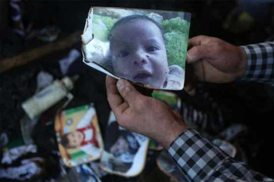 Slain Palestinian toddler's parents, brother fighting for lives