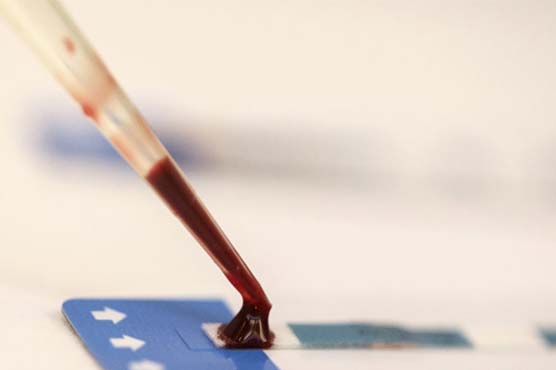 Smartphone can test for HIV, syphilis: study