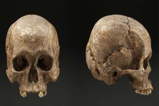 Skull nearly sold as Gettysburg soldier's is 700 years old