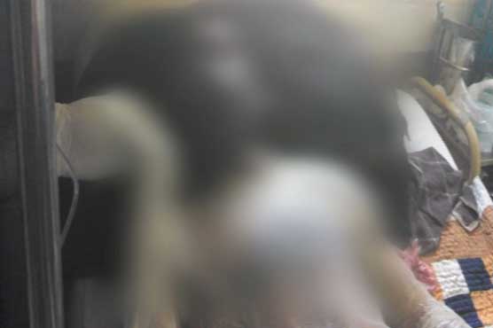 Sadiqabad: 4 women, accomplice set rickshaw driver on fire