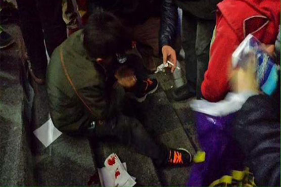 Syrian refugee boy in Turkey beaten for eating leftovers: report