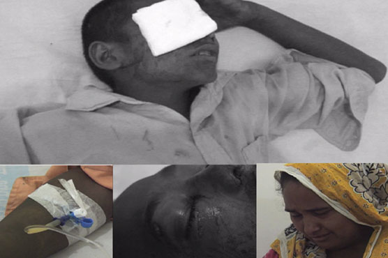 Factory owner targets 10-year-old to brutal torture