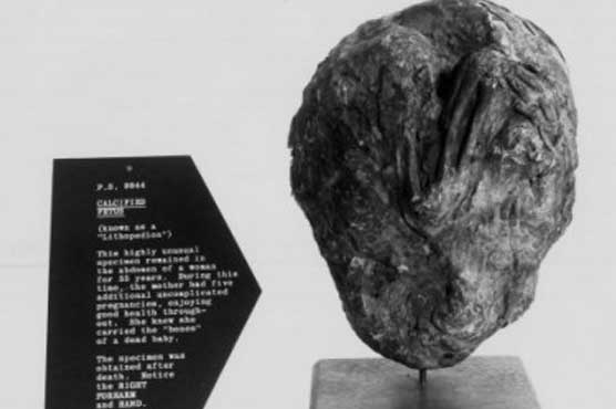 Chilean grandma, 92, discovered bearing mummified fetus